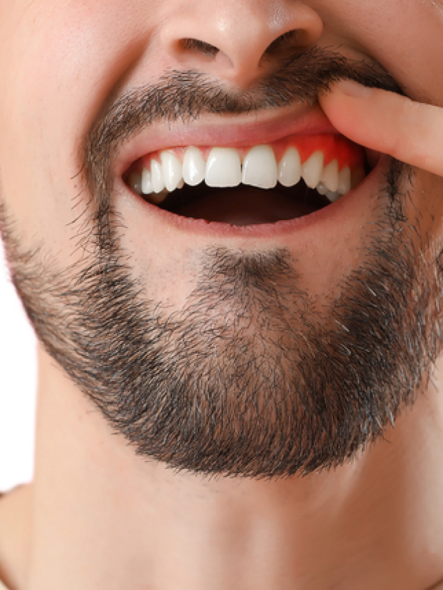 Did you know? You can address and prevent bleeding gums