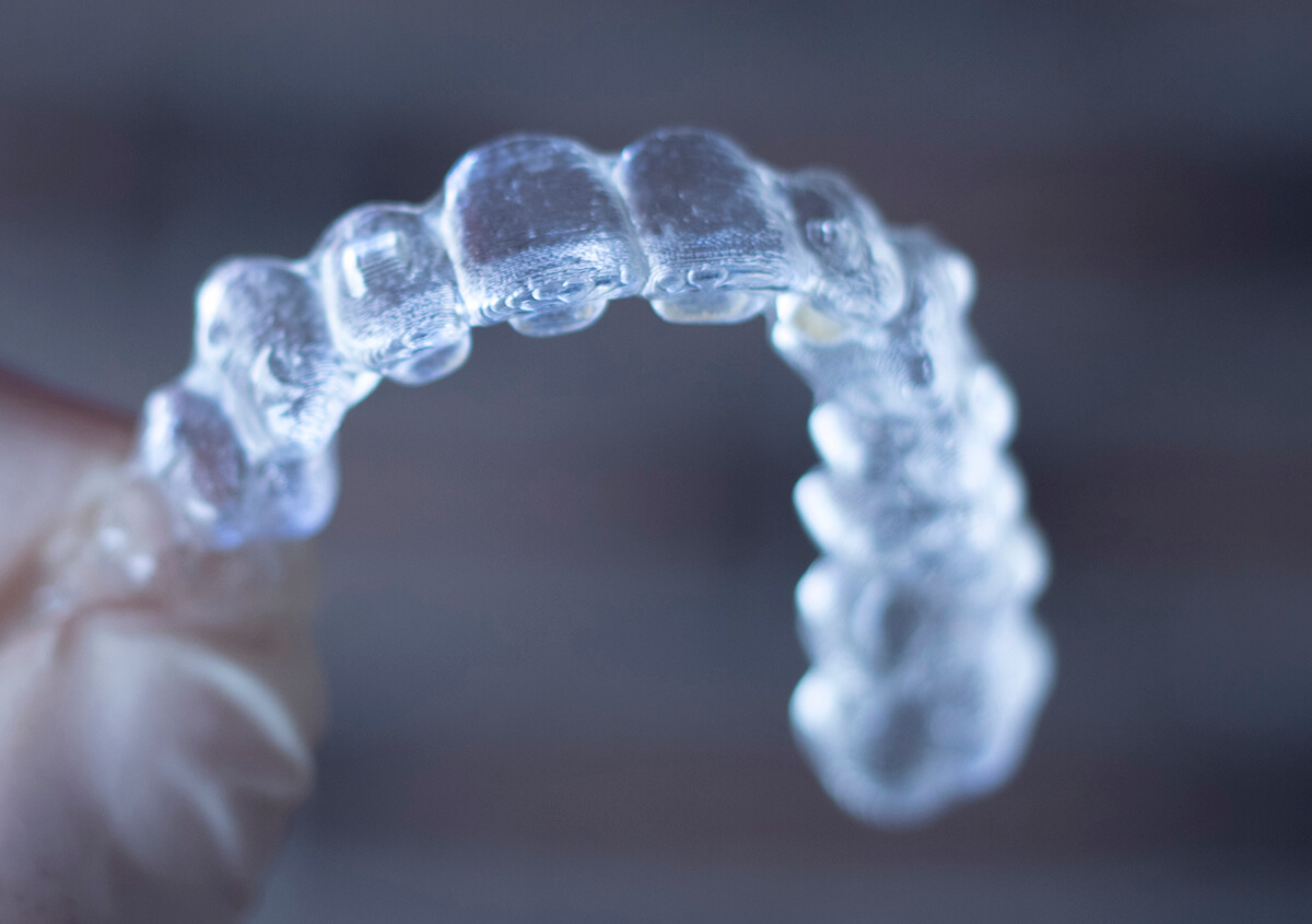 Invisalign for Teeth in Miles City MT Area